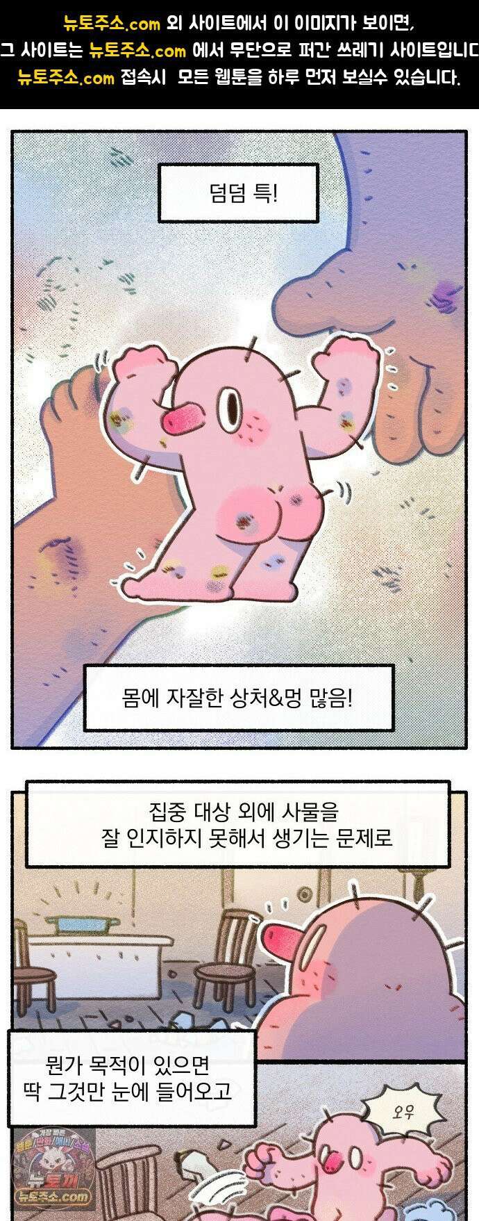 덤벙덤벙 내인생 33화 : 촛대에 발이 뚫렸어요 (1) 1
