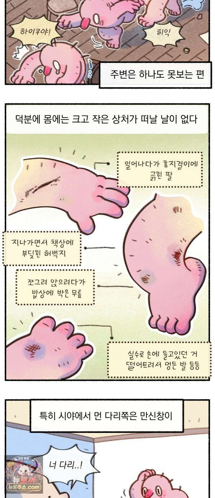 덤벙덤벙 내인생 33화 : 촛대에 발이 뚫렸어요 (1) 2